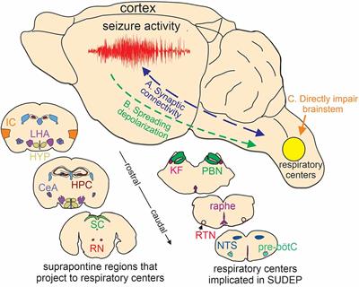 Perspectives on the basis of seizure-induced respiratory dysfunction